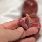 Zdrowie Narodu: Psychiczne i fizyczne skutki aborcji