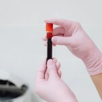 Zdrowie Narodu: Badanie krwi powie wszystko